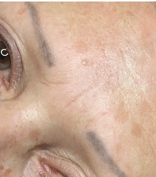 Cejas, antes
