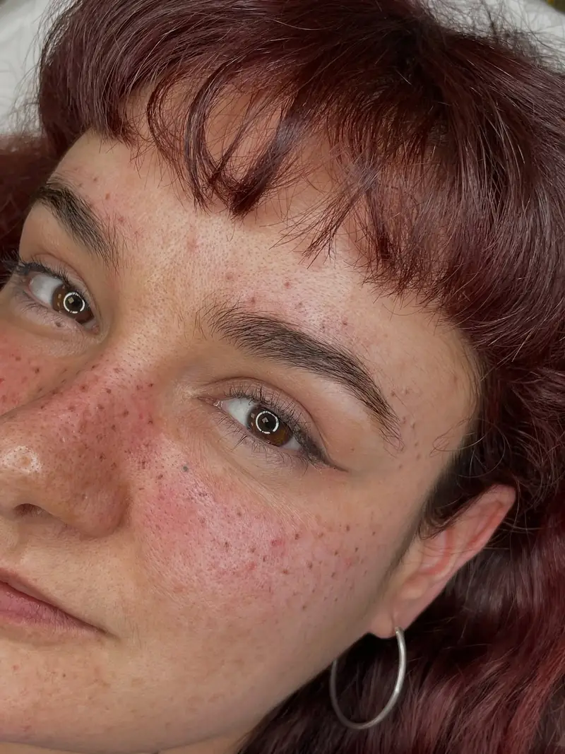 Pecas