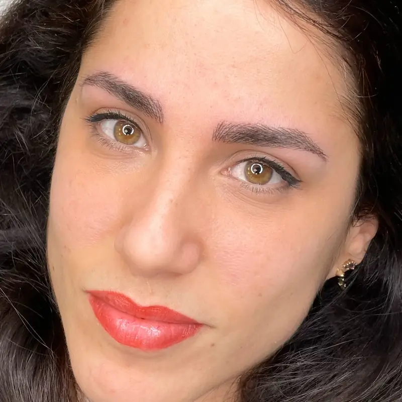 Micro labios