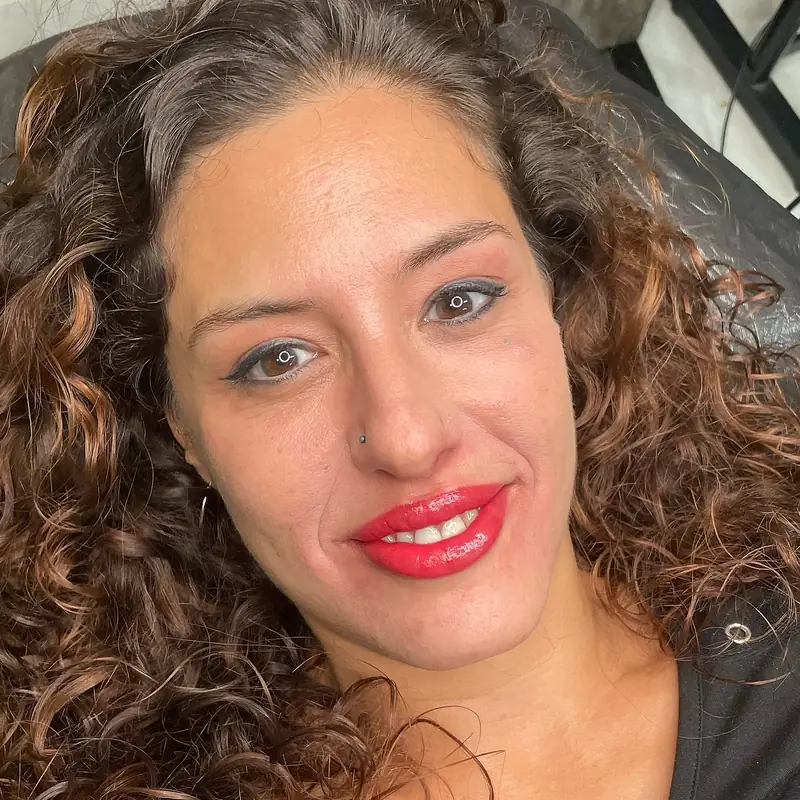 Micro labios