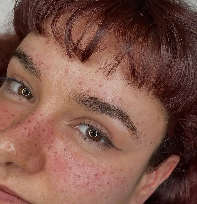 Pecas